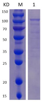 12% SDS-PAGE analysis profiles of purified MCR_RS00365-1-895 (CBB stained).